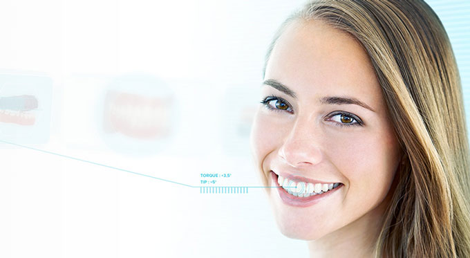 Dental monitoring