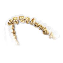 Lingual braces